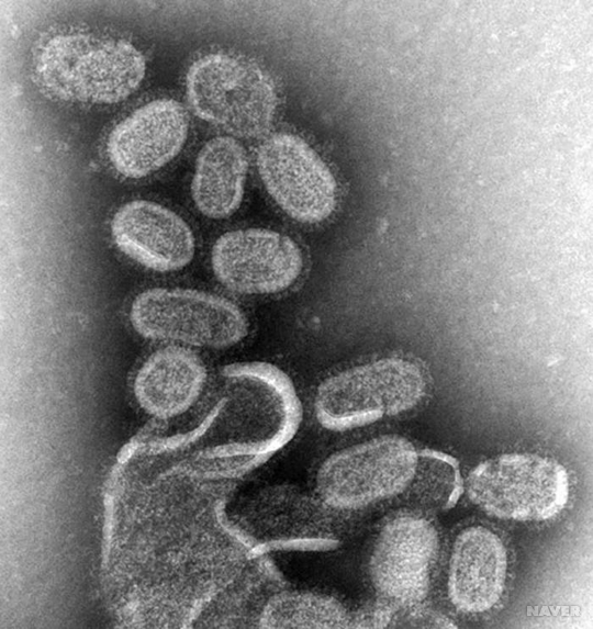 현미경에서 관찰된 인플루엔자바이러스